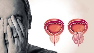 Causes of prostatitis in men