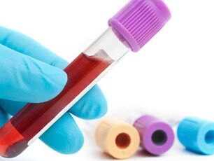 Laboratory methods