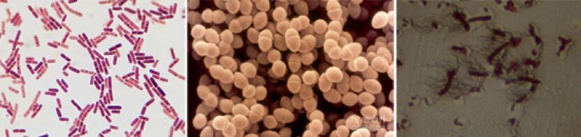 E. coli, fecal enterococci and proteus are the main causative agents of chronic bacterial prostatitis