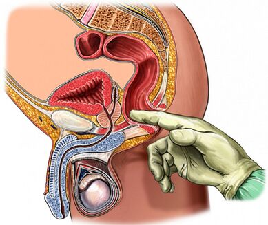 Finger prostate examination