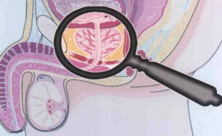 Prostate and location