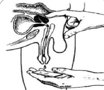Prostate massage for secretion