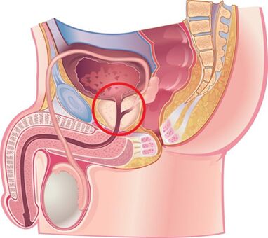 The location of the prostate in men