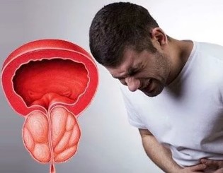 The symptoms of chronic prostatitis in men