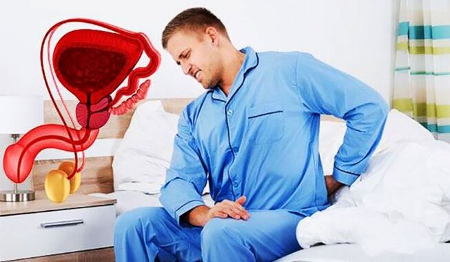 back pain due to prostatitis